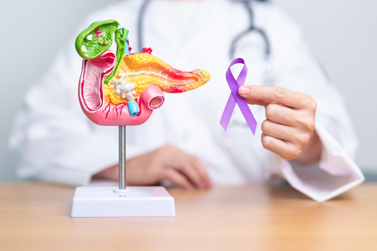 All about Pancreatic Cancer