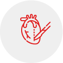 Open Chest CABG Open Chest CABG