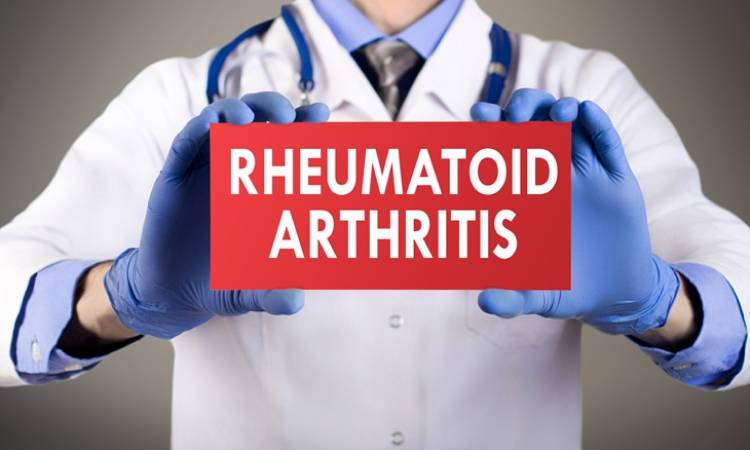 Rheumatoid Arthritis Treatment Expenses