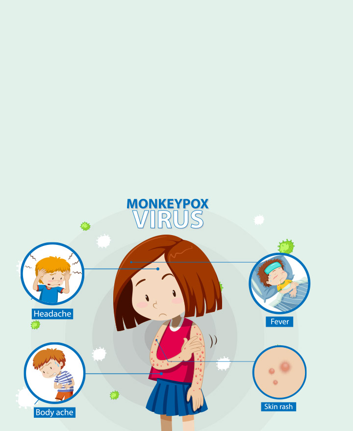 Everything You Need to Know About Monkeypox